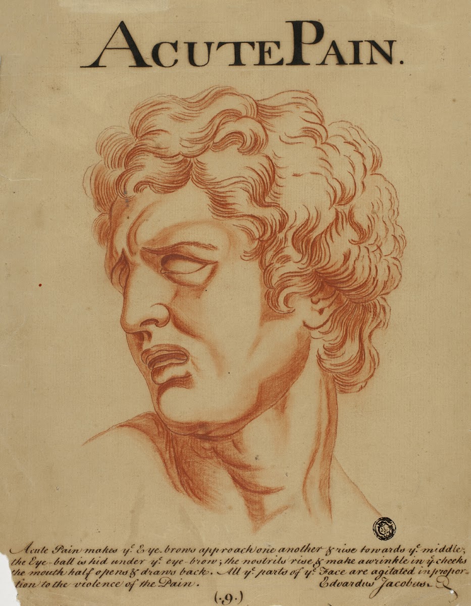 Acute Pain after 1698