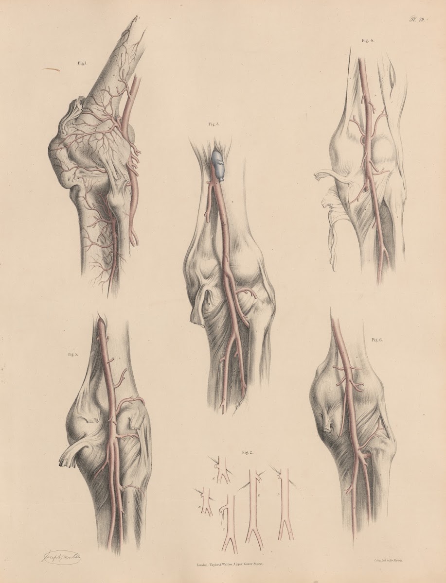 The Popliteal artery and its peculiarities 1844
