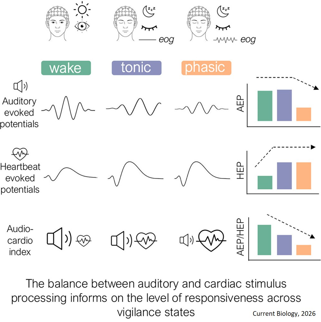 Sensory processing reallocation from auditory to cardiac signals in REM sleep