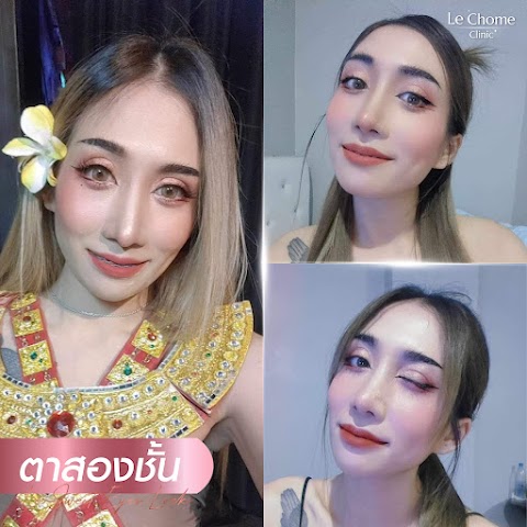 ตา 2 ชั้น