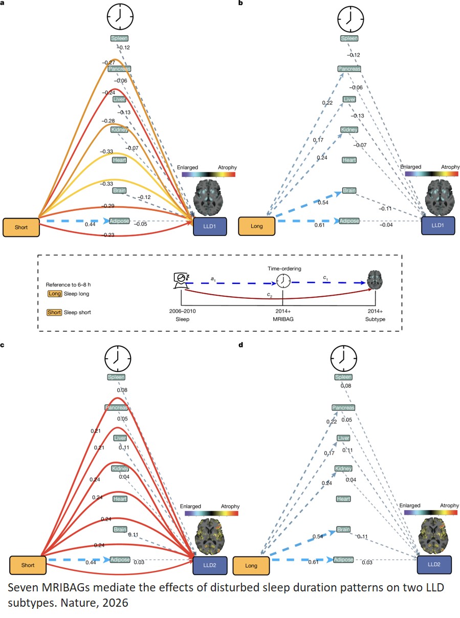 Sleep chart of biological ageing clocks in middle and late life