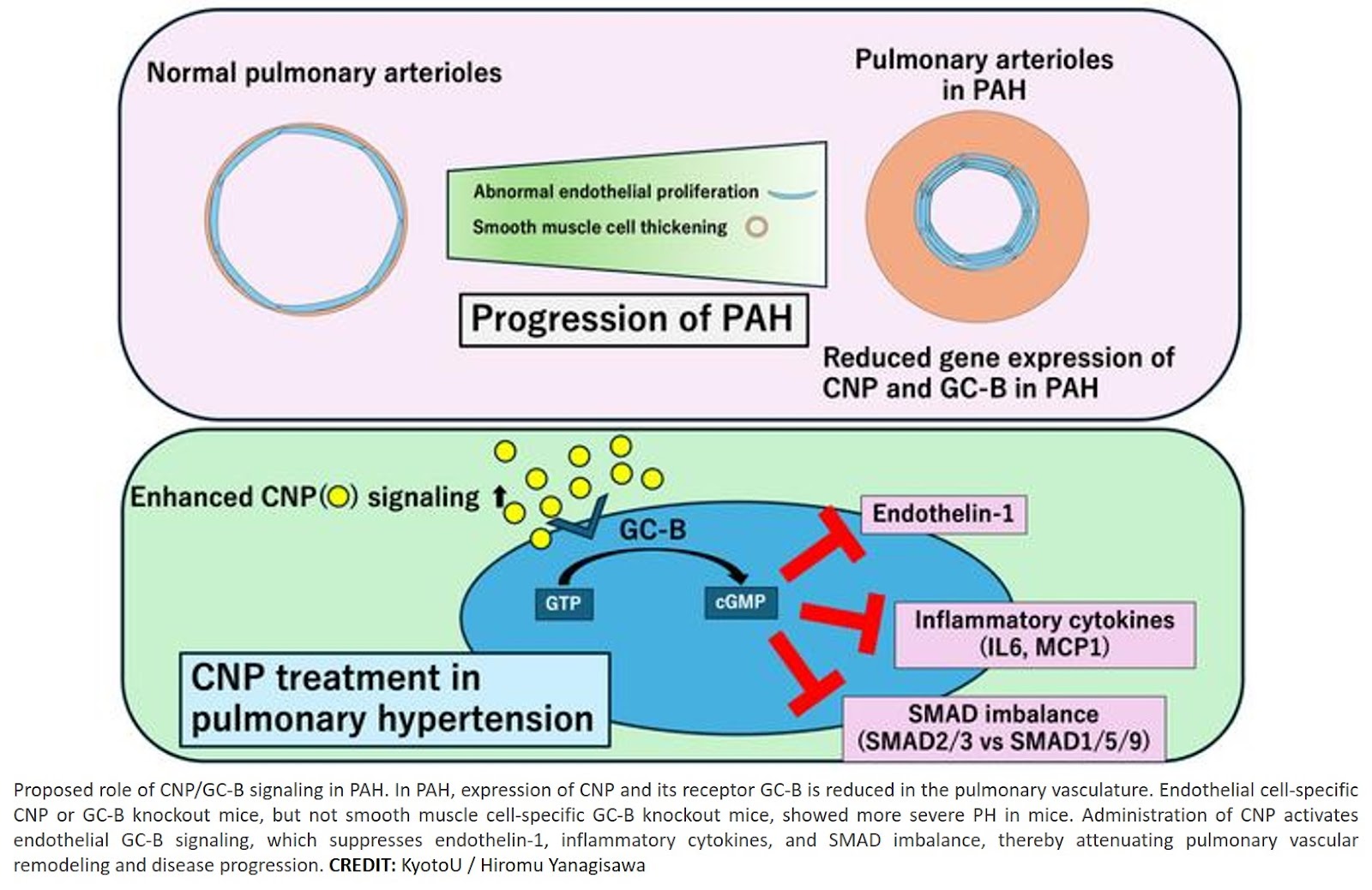 Endothelial C-type natriuretic peptide/ guanylyl cyclase-B signaling prevents pulmonary arterial hypertension