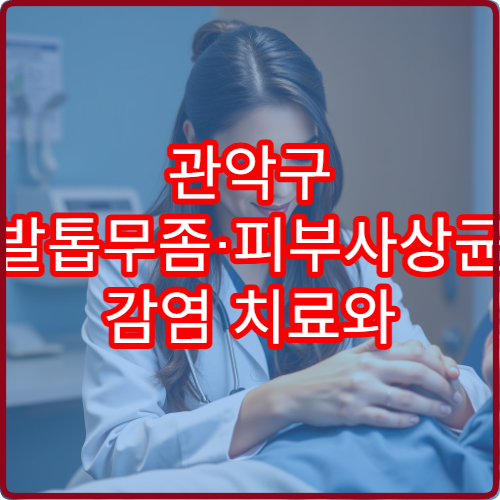 관악구 발톱무좀·피부사상균 감염 치료와 재발 관리 가능한 병원