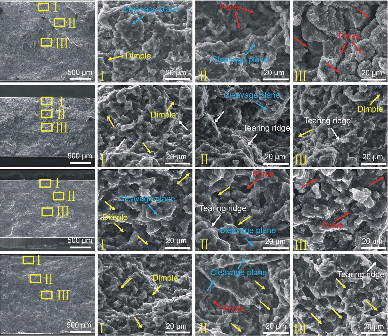 Microstructure and mechanical properties of high pressure die casting AE81 magnesium alloy battery module ends