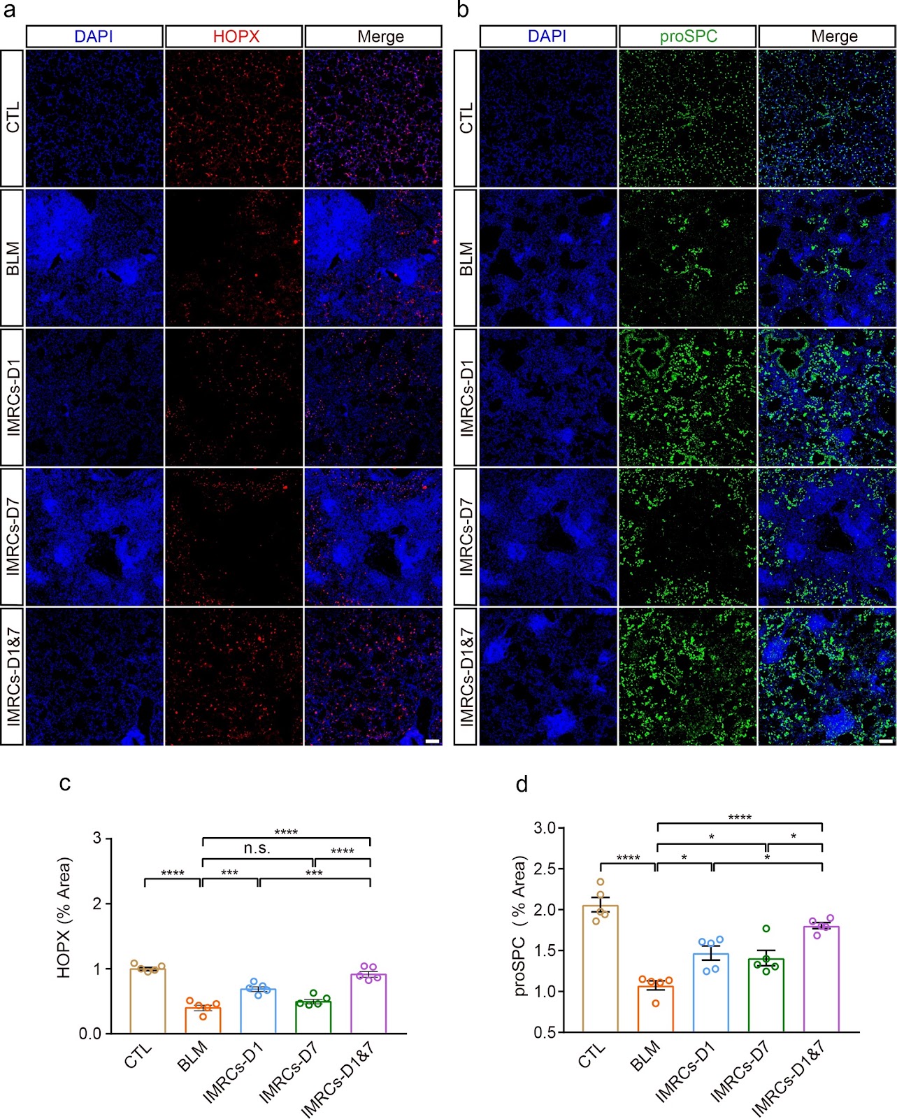 Optimized administration of human embryonic stem cell-derived immunity-and-matrix regulatory cells for mouse lung injury and fibrosis