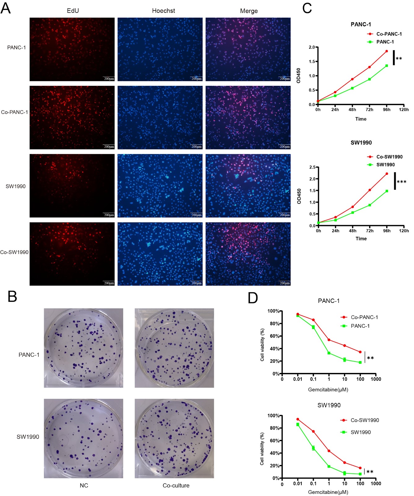 IL15RA-STAT3-GPX4/ACSL3 signaling leads to ferroptosis resistance in pancreatic cancer