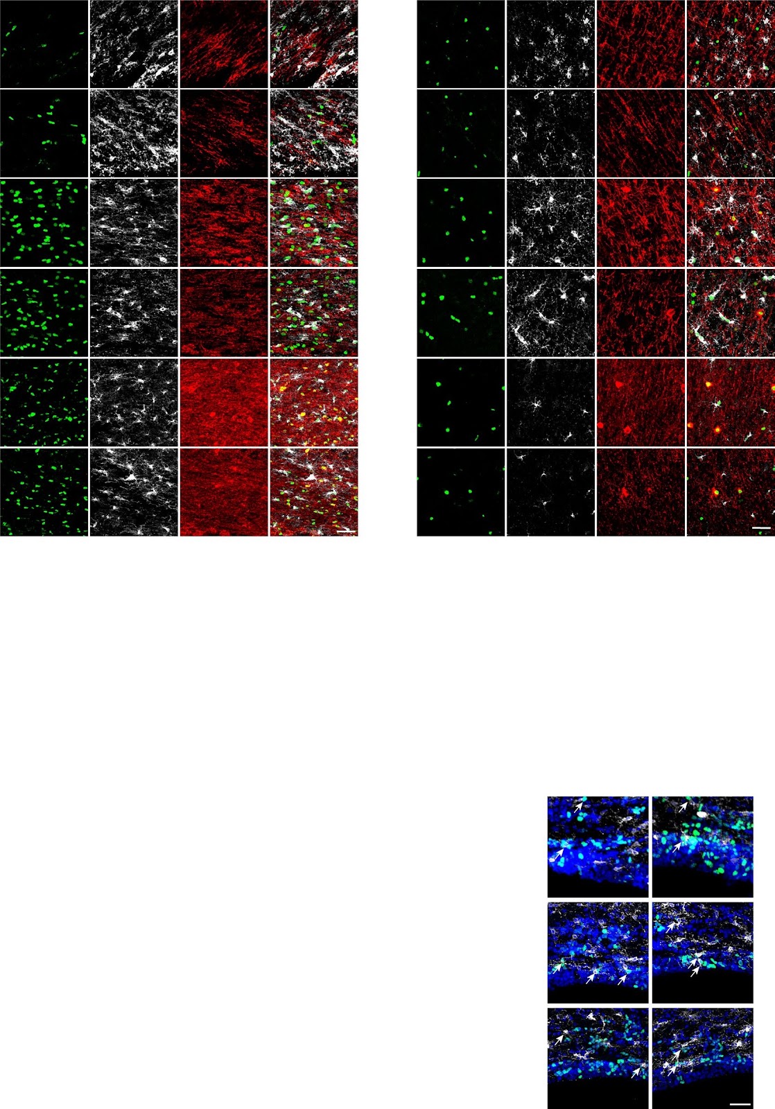 Enhancing myelinogenesis through LIN28A rescues impaired cognition in PWMI mice