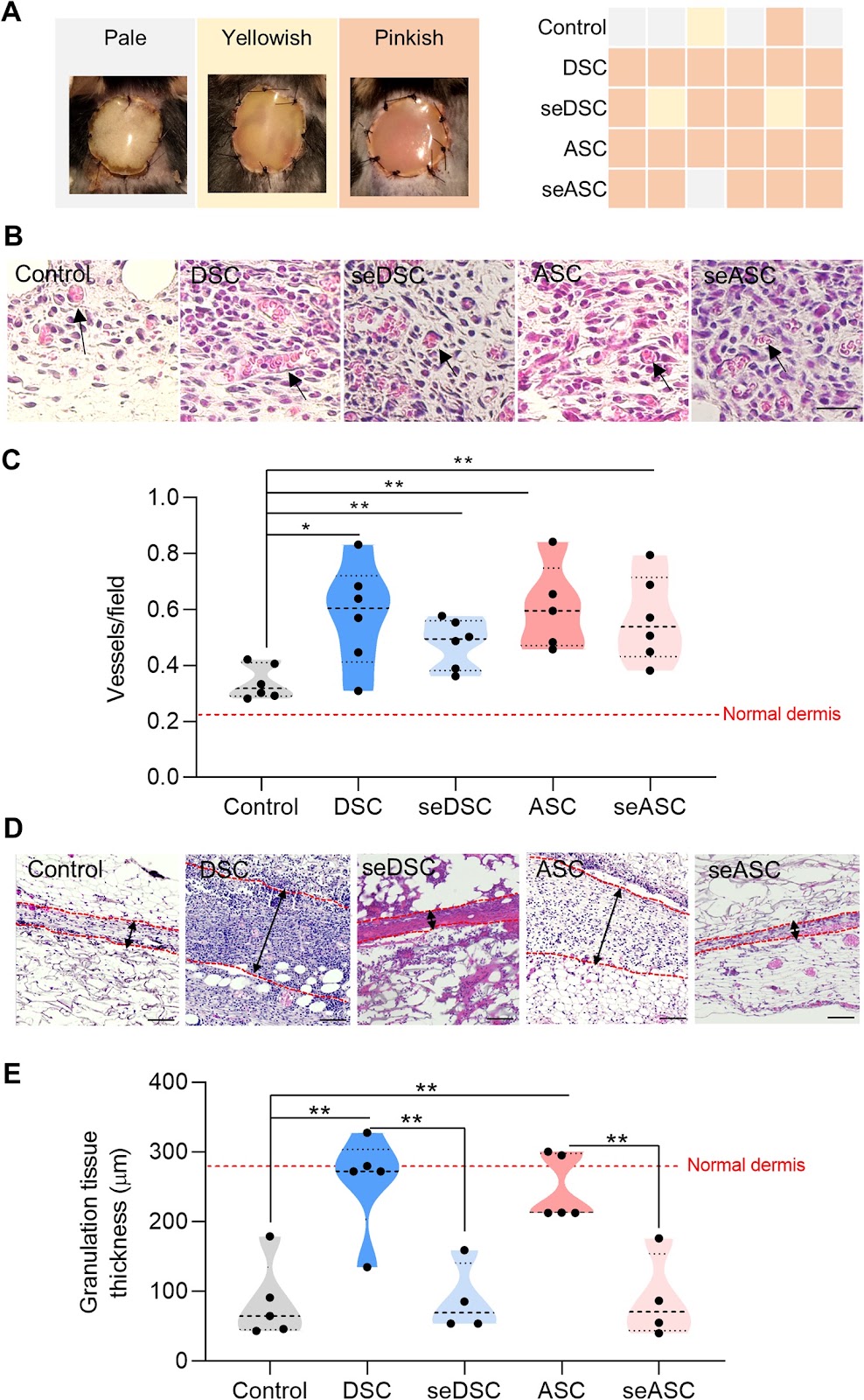Evaluation of secretomes derived from human dermal and adipose tissue mesenchymal stem/stromal cells for skin wound healing: not as effective as cells