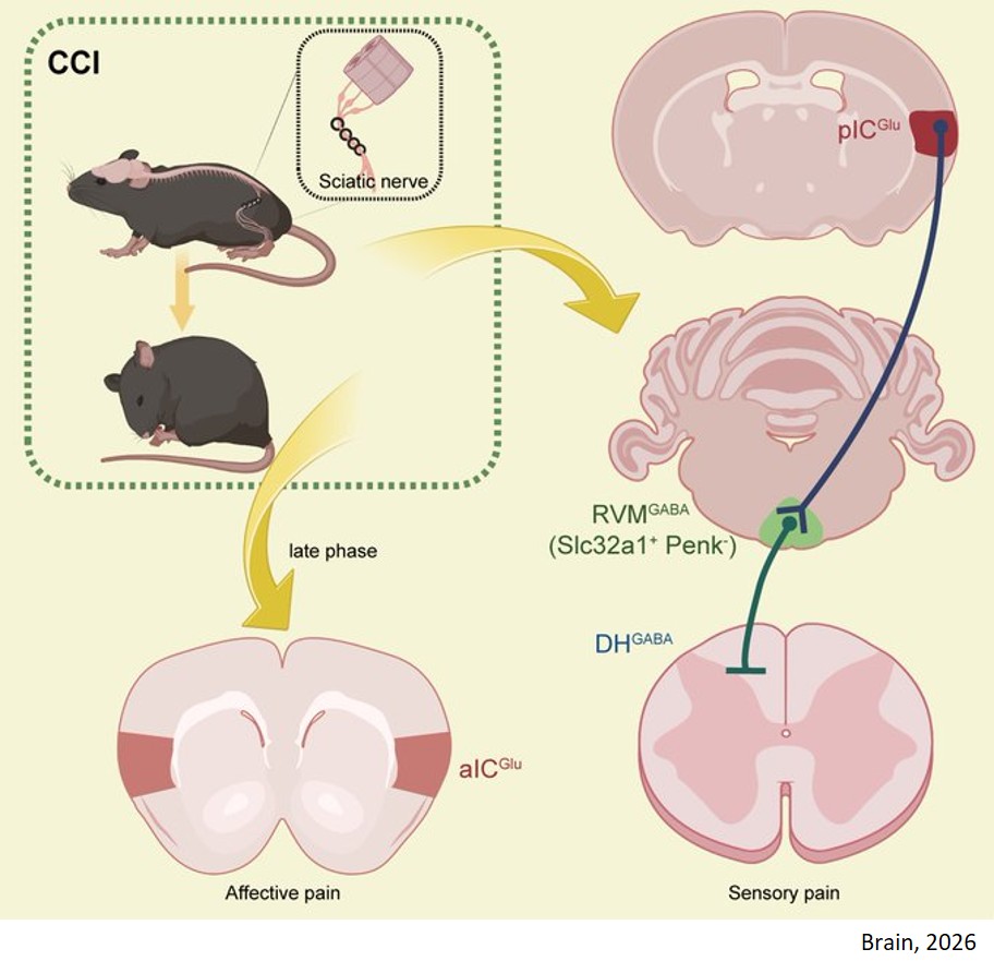 A descending posterior insular pathway drives sensory hypersensitivity in neuropathic pain