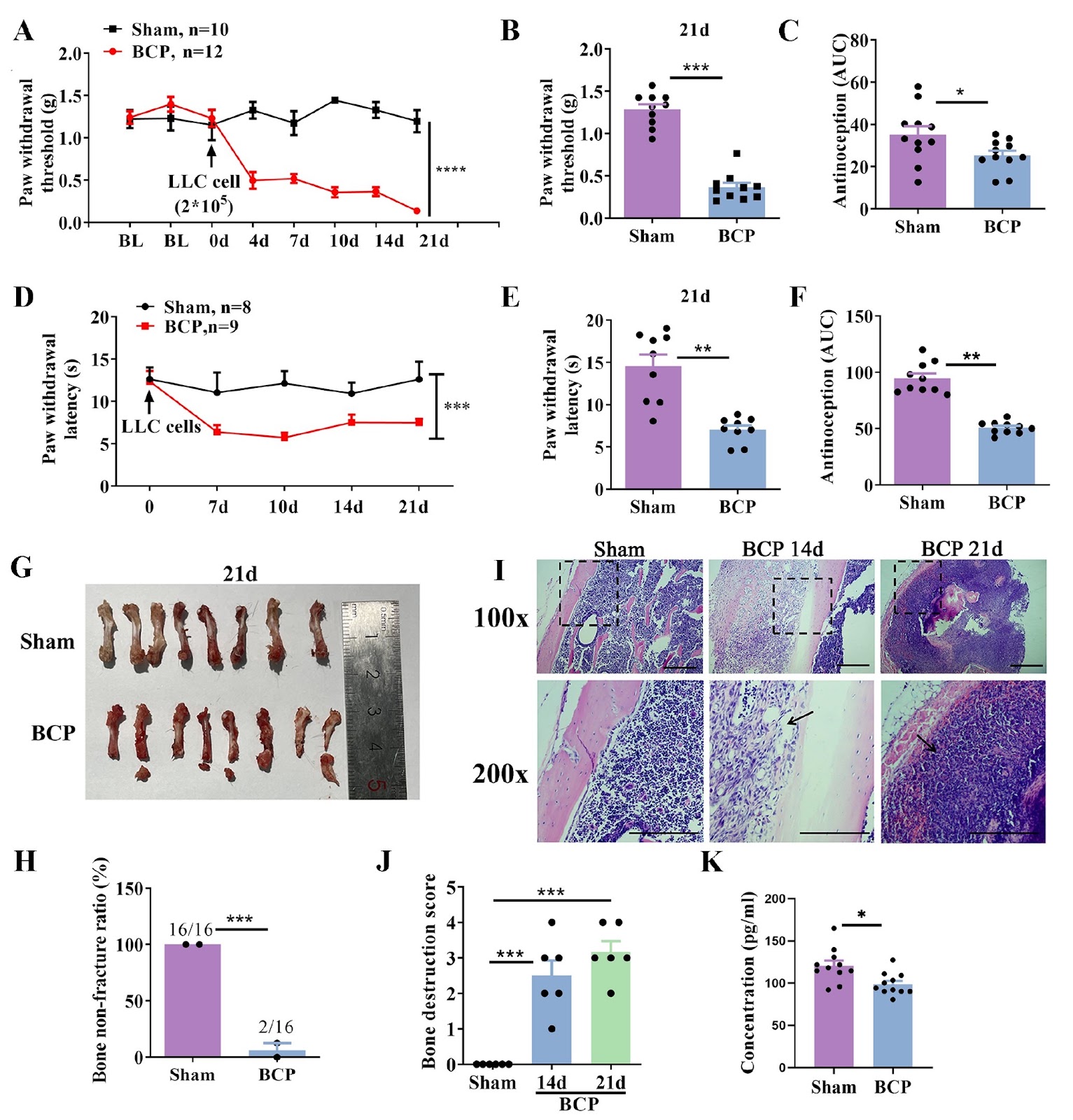 MOTS-c is an effective target for treating cancer-induced bone pain through the induction of AMPK-mediated mitochondrial biogenesis