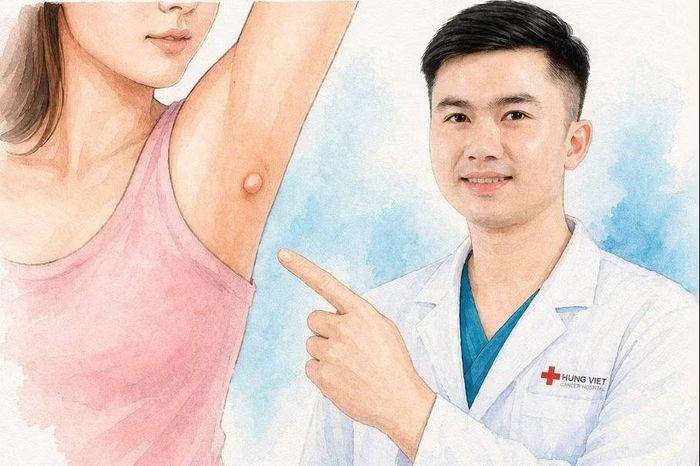 Nách có cục thịt nhỏ có phải u không? - Báo Tri thức &amp; Cuộc sống