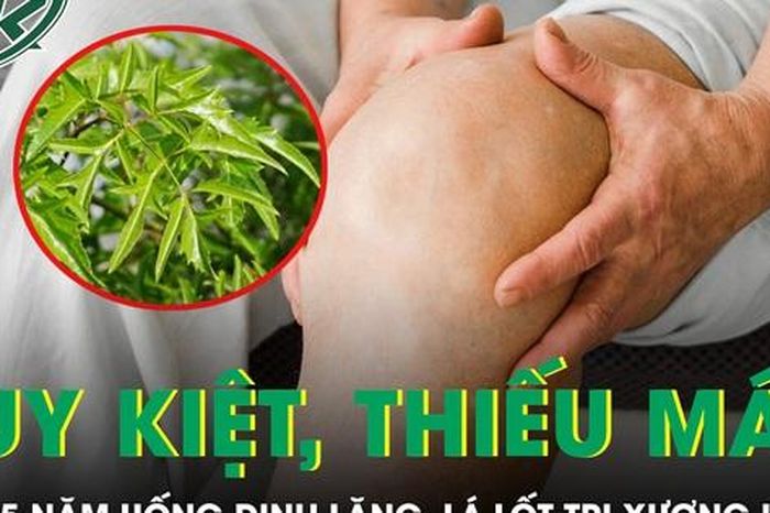 Người đàn ông không thể đi lại sau 15 năm uống đinh lăng, lá lốt trị xương khớp - Báo Sức Khỏe &amp; Đời Sống