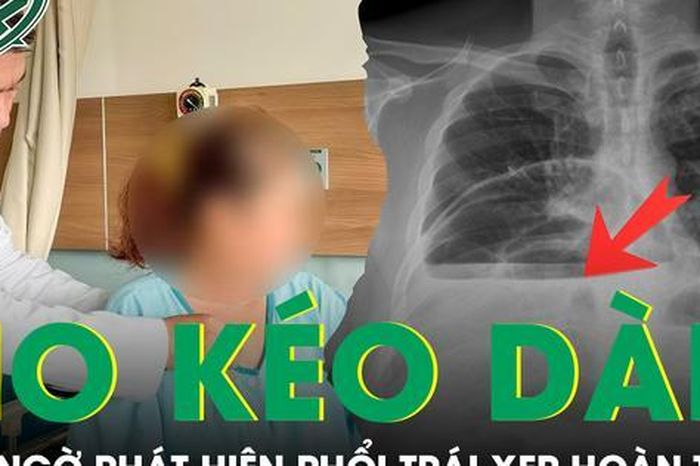 Ho kéo dài nhiều tuần, người phụ nữ bất ngờ phát hiện phổi trái xẹp hoàn toàn vì bệnh hiếm - Báo Sức Khỏe &amp; Đời Sống