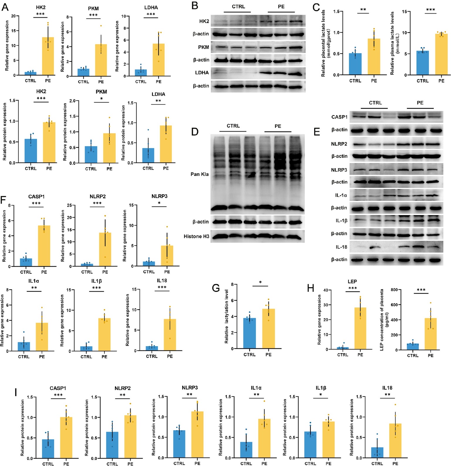 HK2-mediated augmentation of endothelial cell glycolysis promotes placental vascular disorders through lactylation and pyroptosis