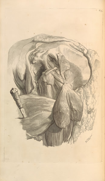 Anatomia humani corporis Pl074 1685