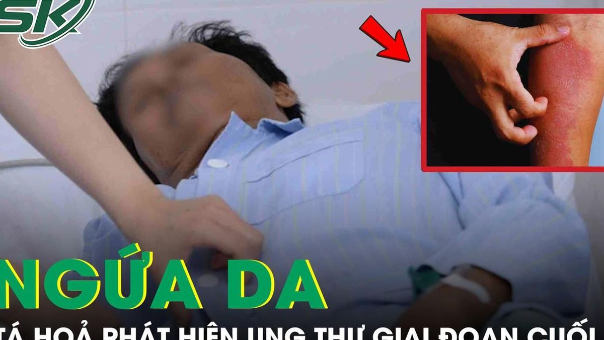 Tá hỏa phát hiện ung thư tụy giai đoạn cuối từ dấu hiệu ngứa da - Báo Sức Khỏe &amp; Đời Sống