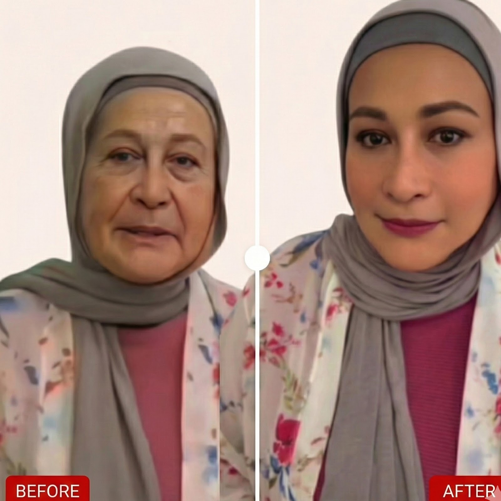 Before and After Result