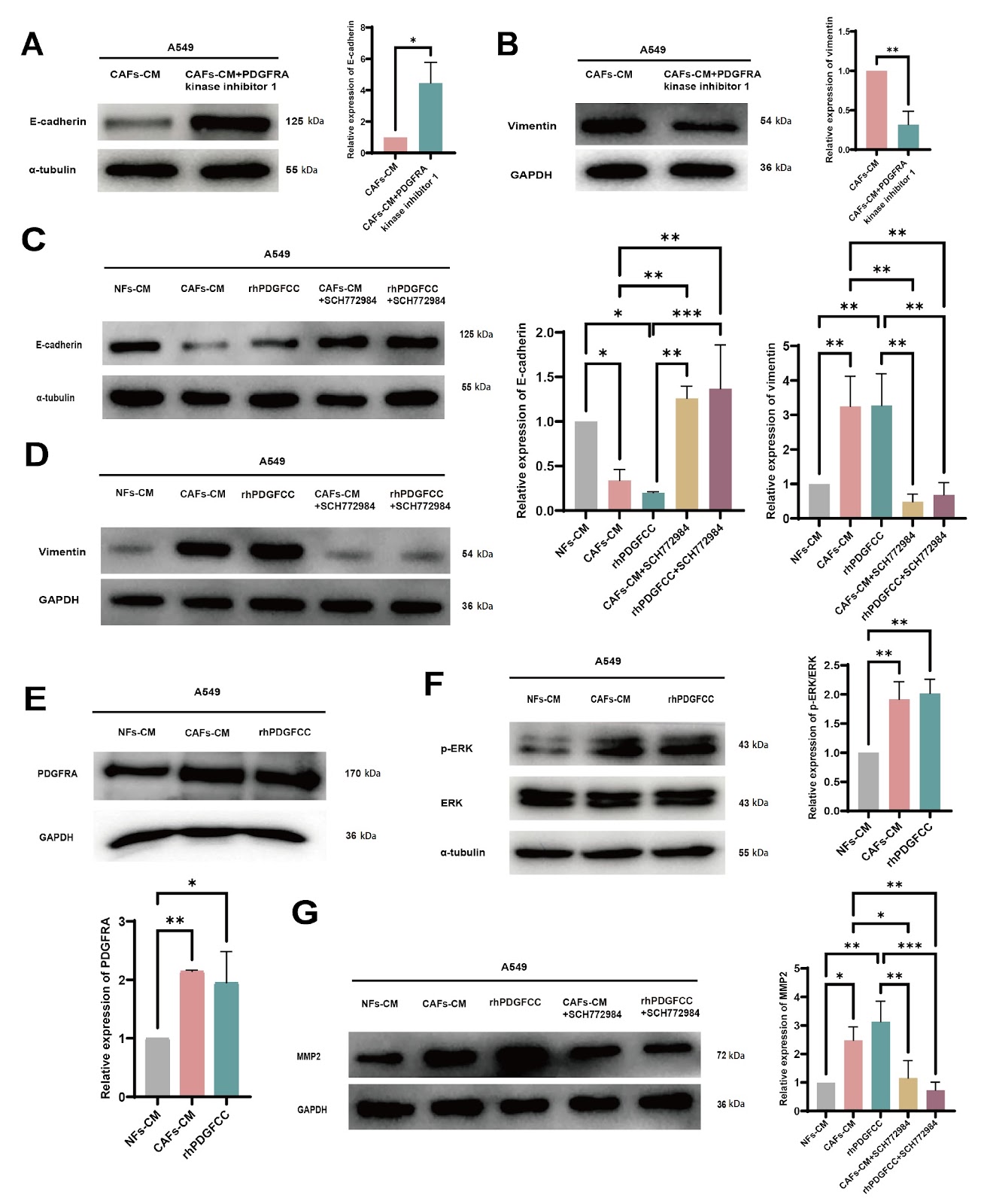 PDGFC secreted by cancer-associated fibroblasts promotes epithelial-mesenchymal transition and immunosuppression in lung adenocarcinoma