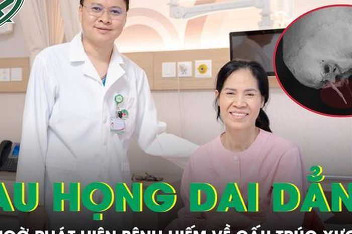 Thường xuyên bị đau họng, người phụ nữ bất ngờ phát hiện bệnh hiếm khi đi khám - Báo Sức Khỏe &amp; Đời Sống