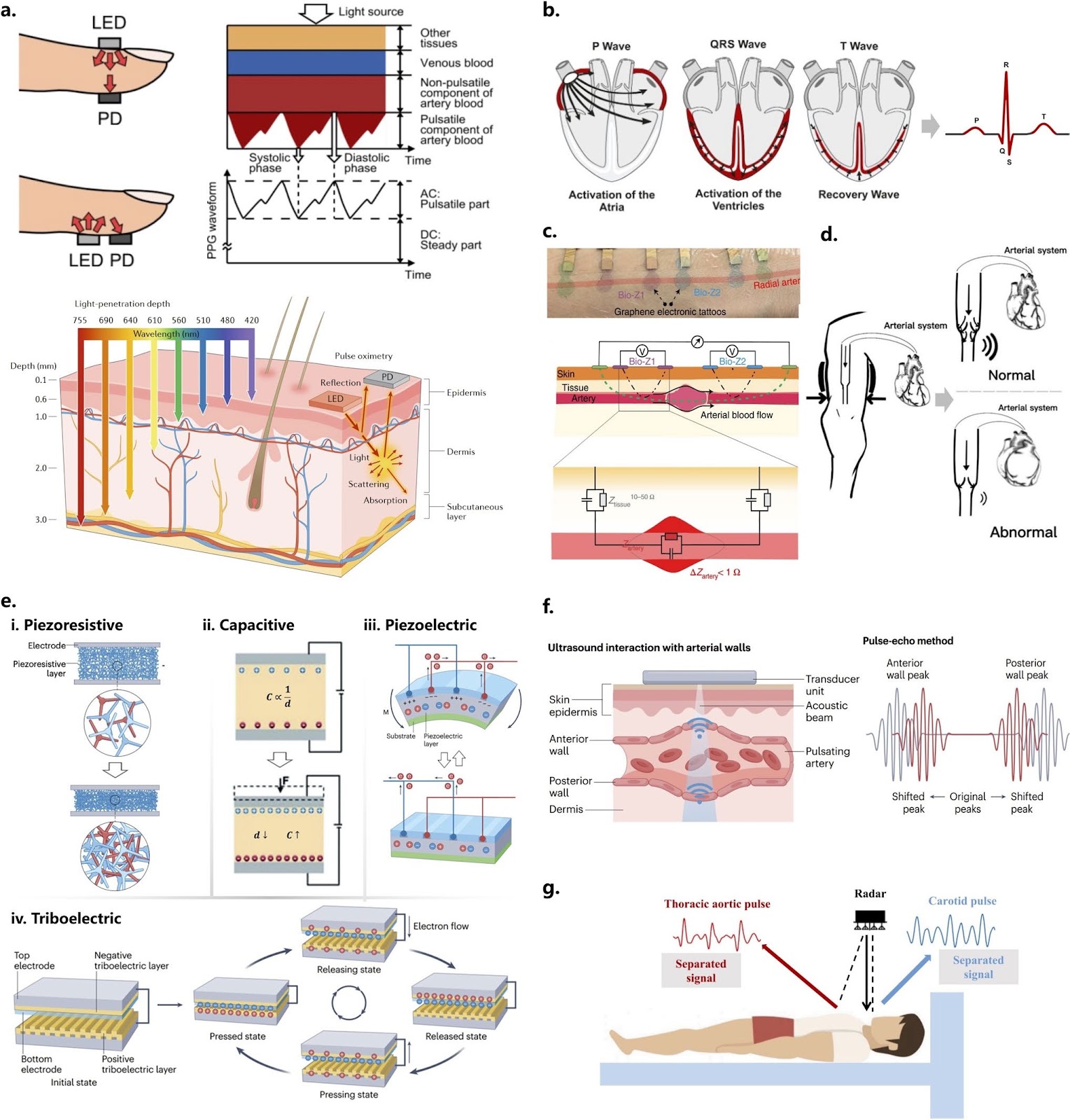 Artificial Intelligence-Enhanced Wearable Blood Pressure Monitoring in Resource-Limited Settings: A Co-Design of Sensors, Model, and Deployment