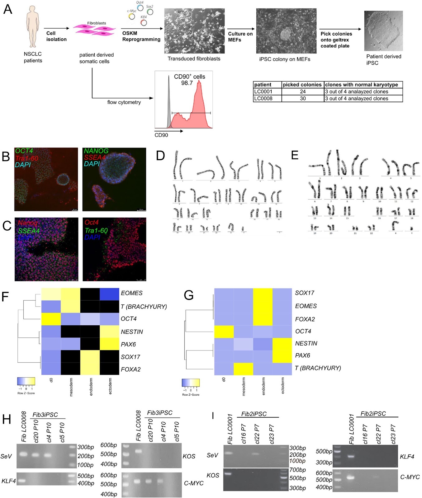 iPSC-derived lung and lung cancer organoid model to evaluate cisplatin encapsulated autologous iPSC-derived mesenchymal stromal cell-isolated extracellular vesicles