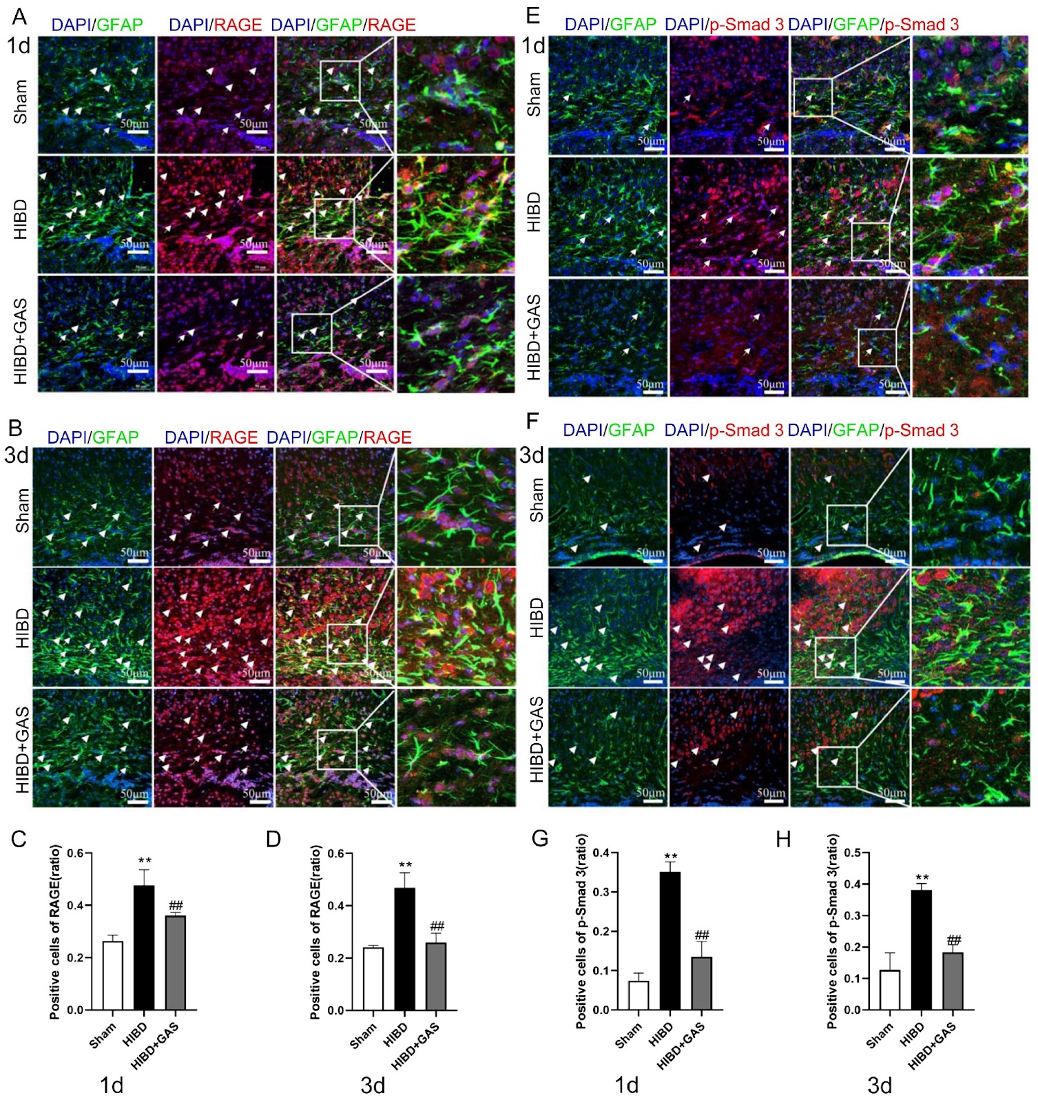 Gastrodin inhibits reactive astrocyte-mediated inflammation in hypoxic-ischemic brain damage through S100B/RAGE-Smad3 signaling