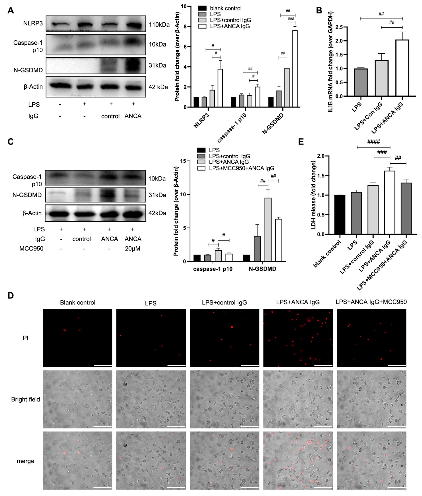 NLRP3 Inflammasome Activity and Pyroptosis Are Involved in CD206+ Macrophage Activation by MPO Anti-Neutrophil Cytoplasmic Antibodies