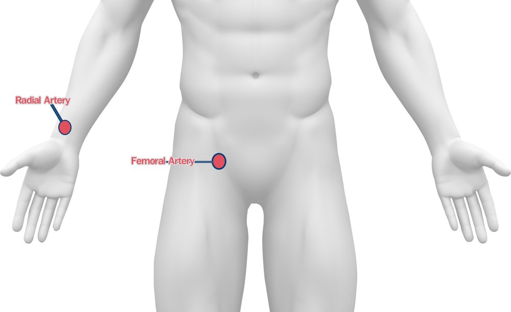 ตำแหน่งแทงเข็ม