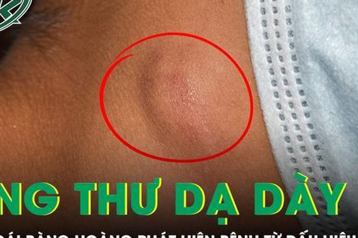 Cô gái 20 tuổi bàng hoàng phát hiện mắc ung thư dạ dày di căn toàn thân từ dấu hiệu ở cổ - Báo Sức Khỏe &amp; Đời Sống