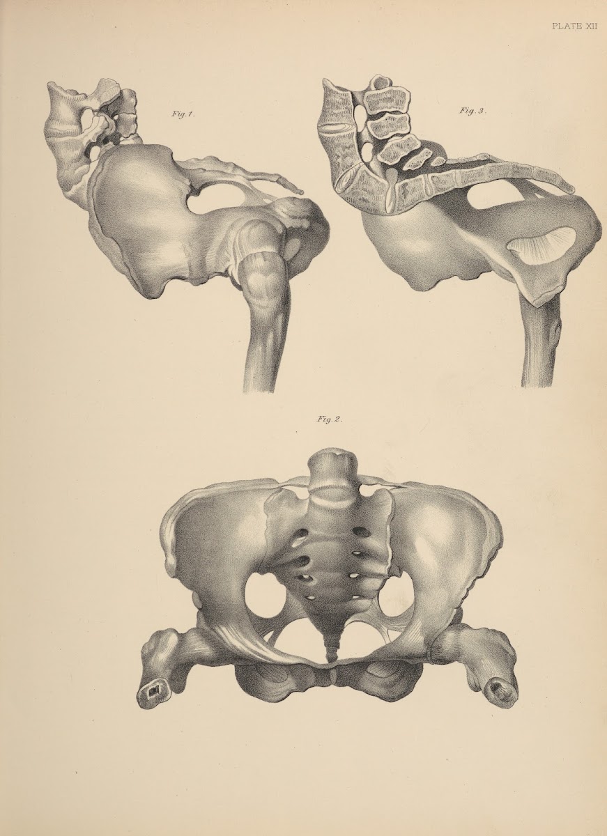 Malformations of the Pelvis 1885