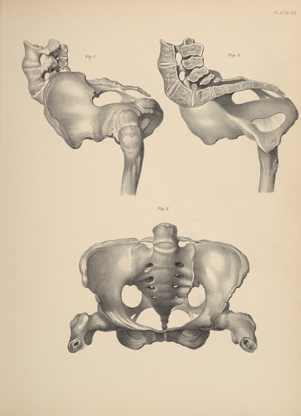 Malformations of the Pelvis 1885