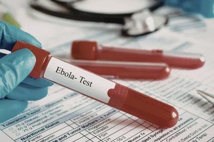 TP HCM siết giám sát cửa khẩu để ngăn nguy cơ dịch xâm nhập dịch Ebola - Báo Tri thức &amp; Cuộc sống