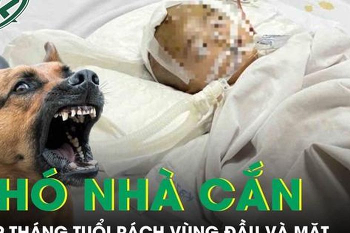 Chó nhà cắn, bé 19 tháng tuổi rách sâu vùng đầu và mặt phải cấp cứu - Báo Sức Khỏe &amp; Đời Sống