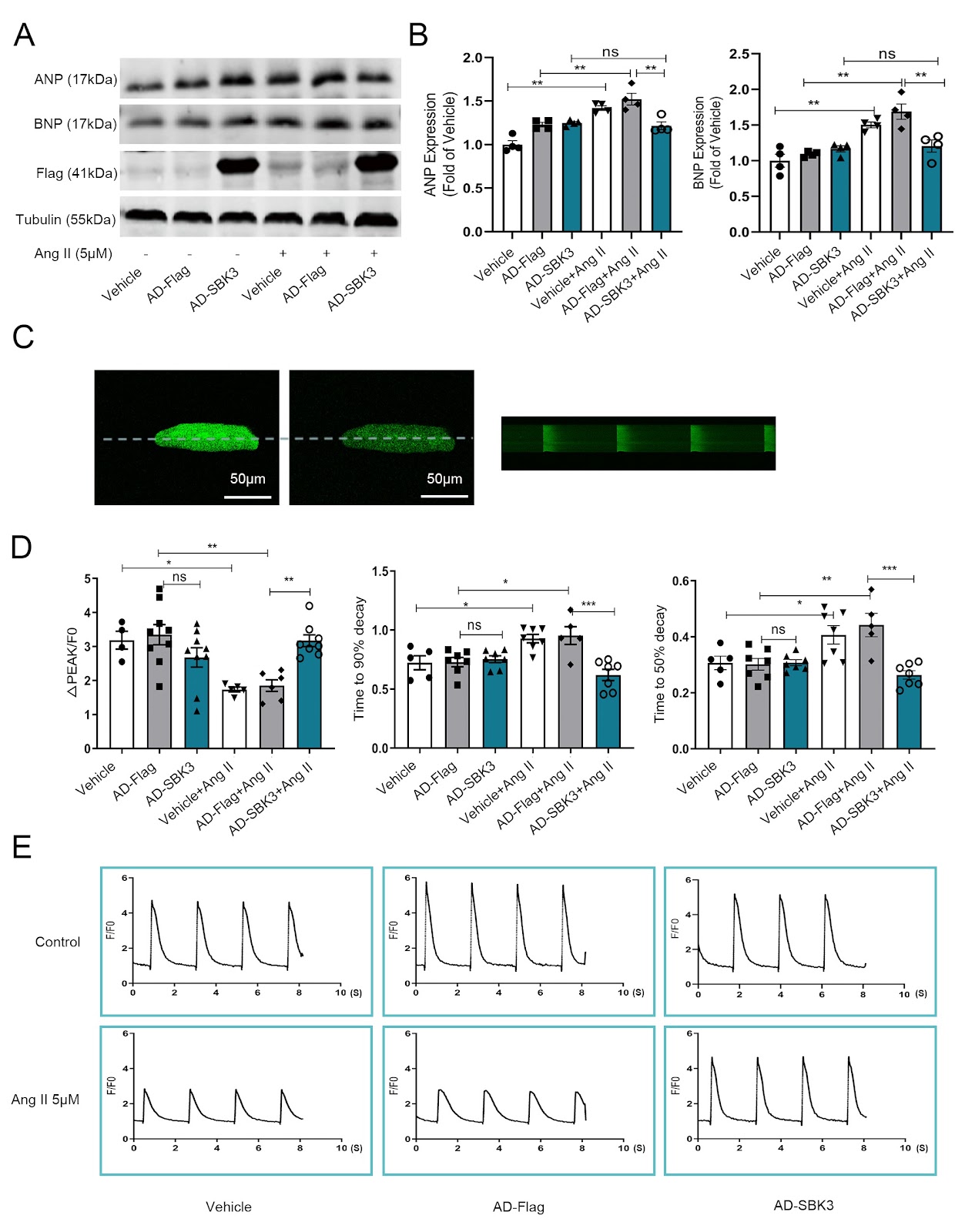 Mitochondria-resident SBK3 confers protection against pressure overload-induced heart failure in mice