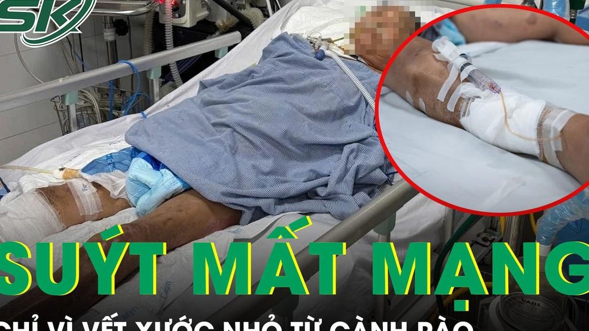 Vết xước nhỏ từ cành rào khiến người đàn ông 65 tuổi nguy kịch vì uốn ván - Báo Sức Khỏe &amp; Đời Sống