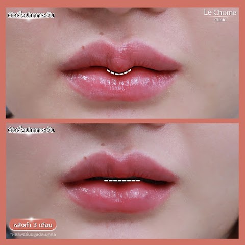 ตกแต่งริมฝีปาก