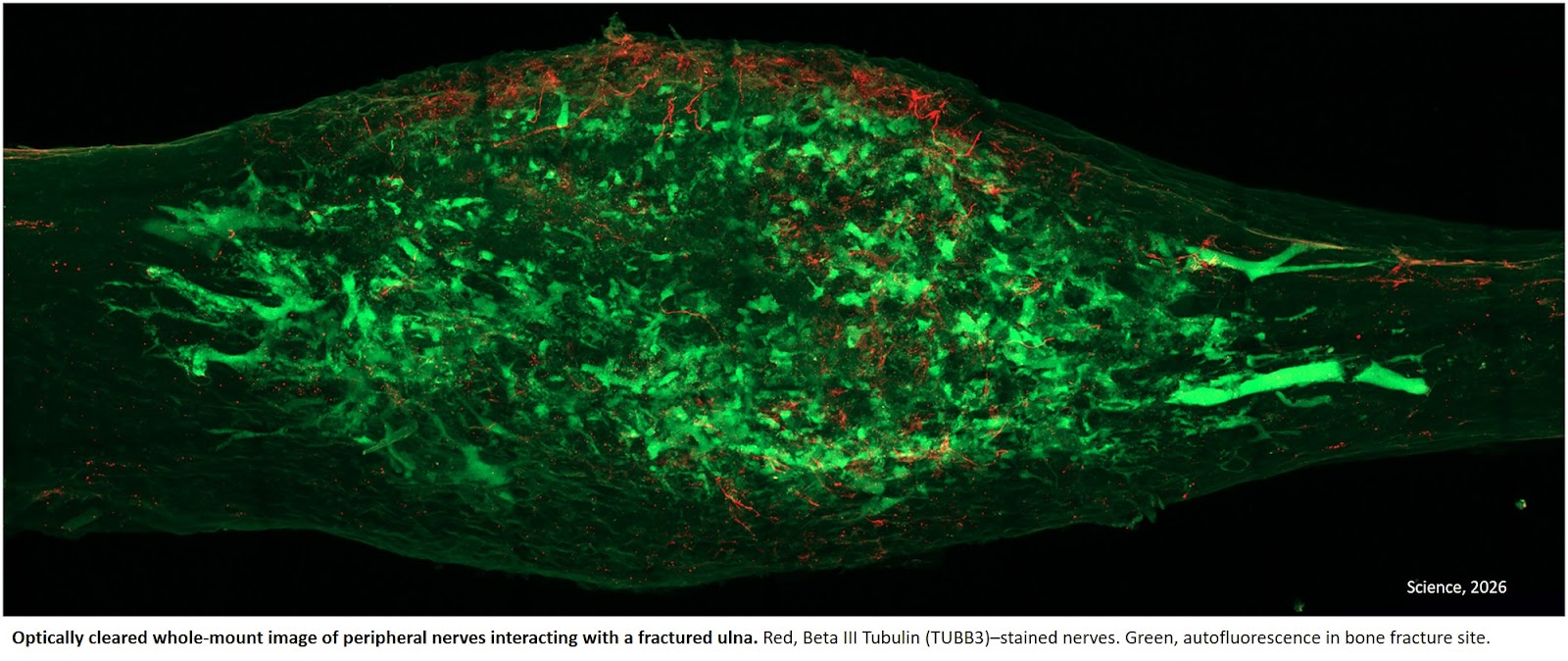 Neural circuitry in bone and key signals for bone repair