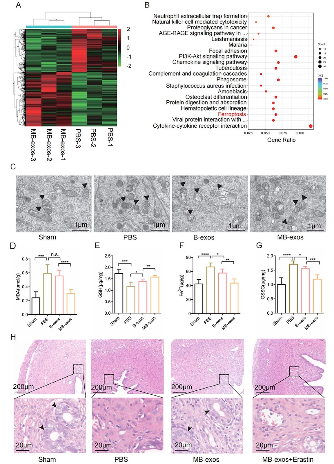 Correction: Mir-340-3p-modified bone marrow mesenchymal stem cell-derived exosomes inhibit ferroptosis through METTL3-mediated m6A modification of HMOX1 to promote recovery of injured rat uterus