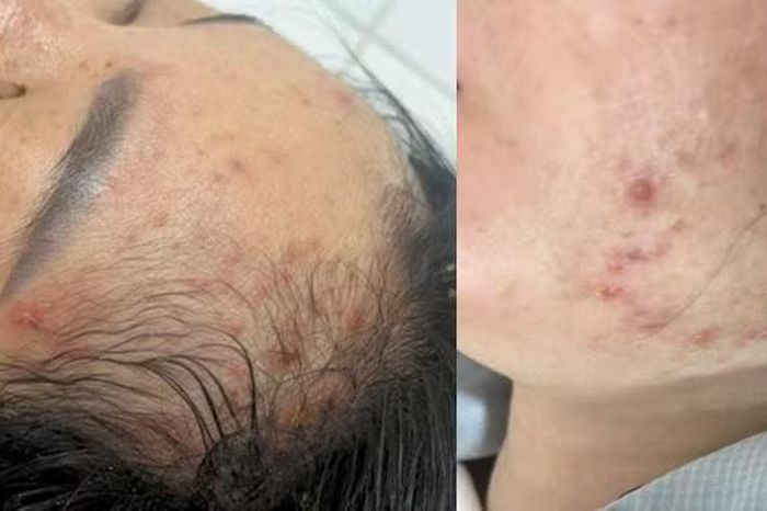 Thủy đậu trong thai kỳ, nguy cơ 'kép' cho cả mẹ và con - Báo Tri thức &amp; Cuộc sống