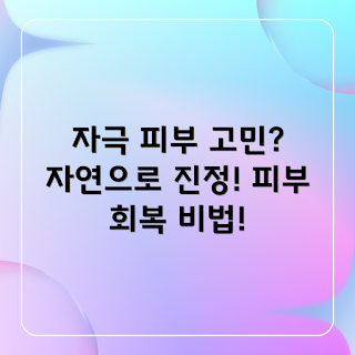 자극받은 피부, 자연 유래 진정, 피부 진정 케어, 자극 완화, 피부 건강 관리