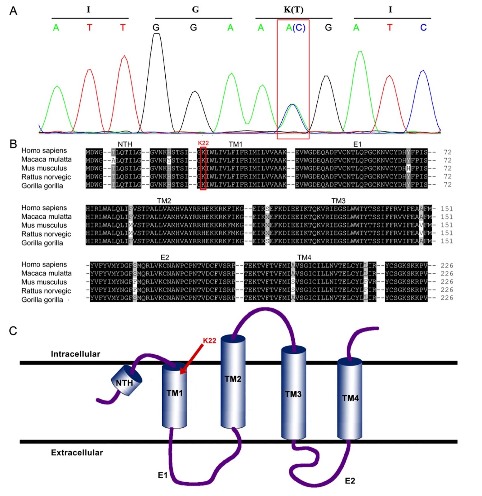 Unveiling a novel GJB2 dominant K22T mutation in a Chinese family with hearing loss