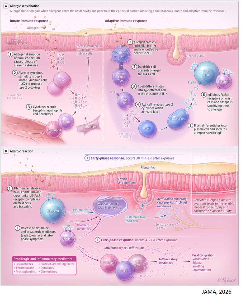Allergic Rhinitis