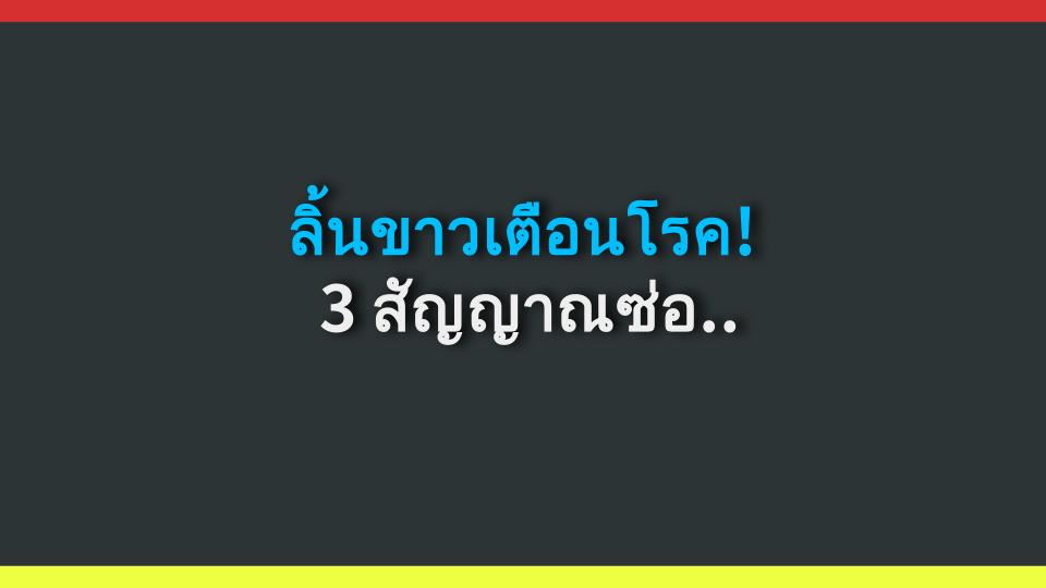 ลิ้นขาวเตือนโรค! 3 สัญญาณซ่อนเร้นที่หมอห่วง