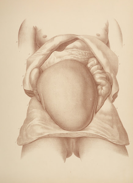 Exhibits the Form Size and Situation of the Uterus completely Developed by the P