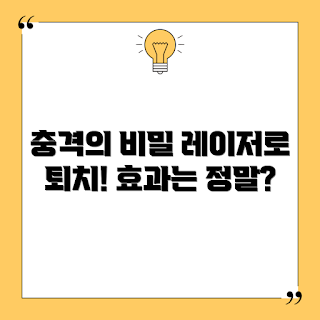 레이저조류퇴치기, 조류 퇴치 방법, 효과적인 조류 방지, 레이저 퇴치기 원리, 조류 피해 예방