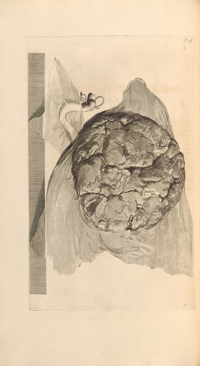 Anatomia humani corporis Pl059 1685