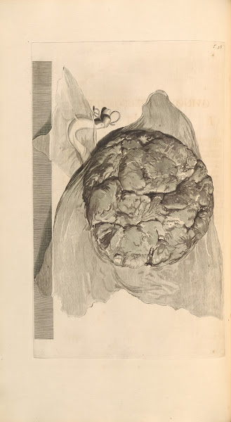 Anatomia humani corporis Pl059 1685