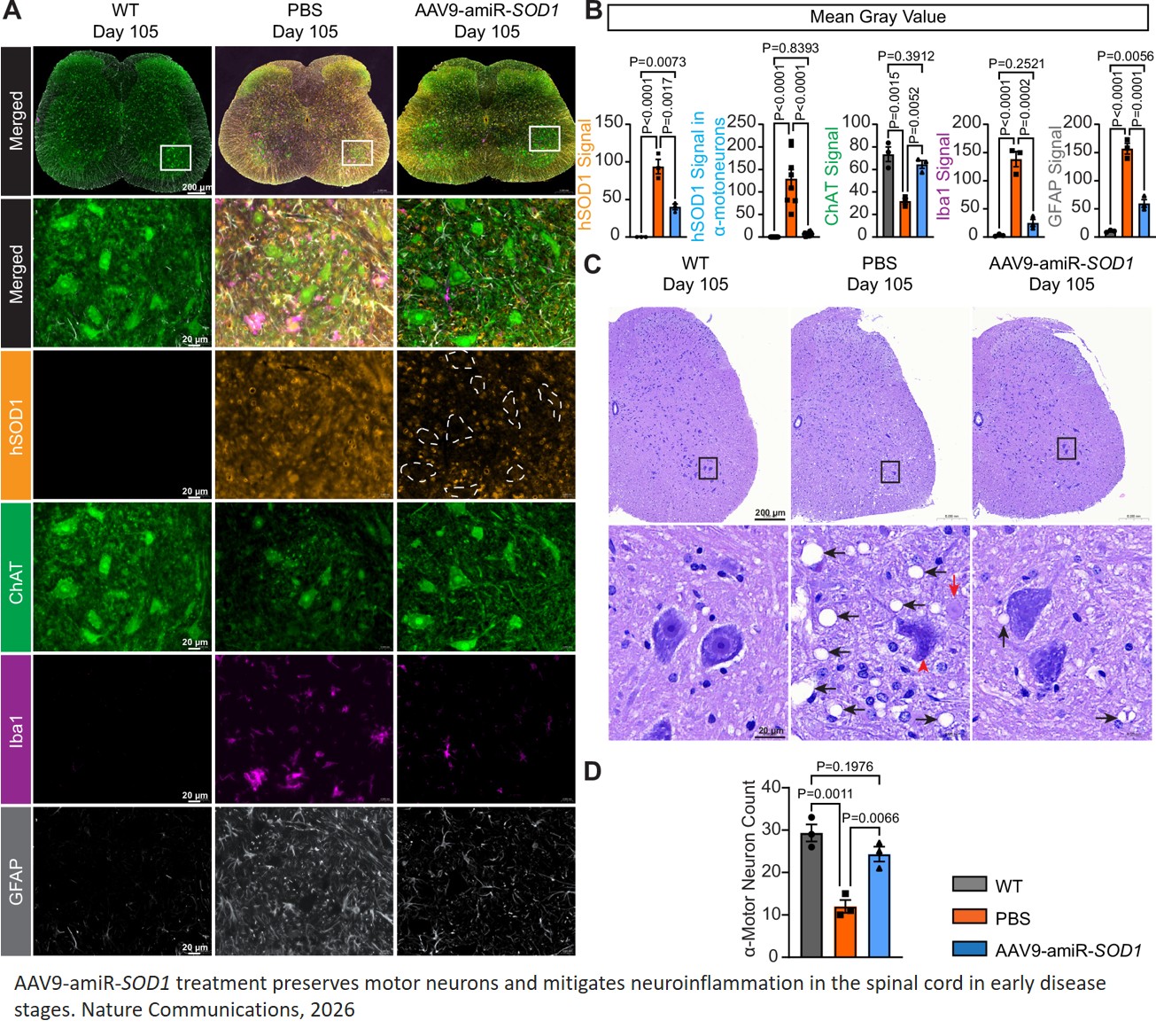 Intravenous administration of an engineered AAV9-gene-silencing vector suppresses human SOD1 and extends survival in an ALS mouse model