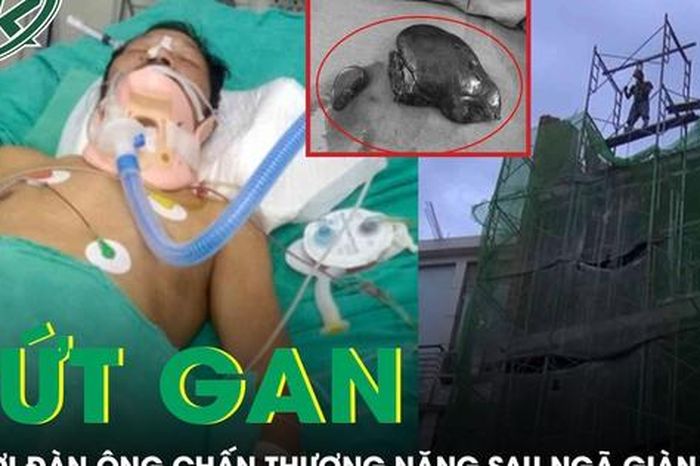 Người đàn ông đứt gan, tràn máu màng phổi sau khi ngã giàn giáo - Báo Sức Khỏe &amp; Đời Sống