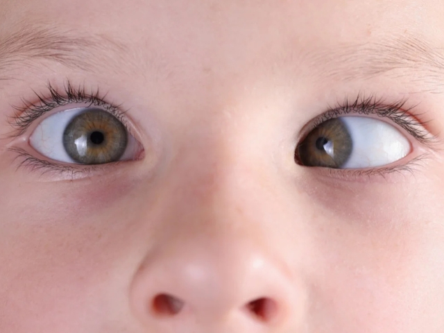Child having a gentle squint assessment at Dayal Eye Centre